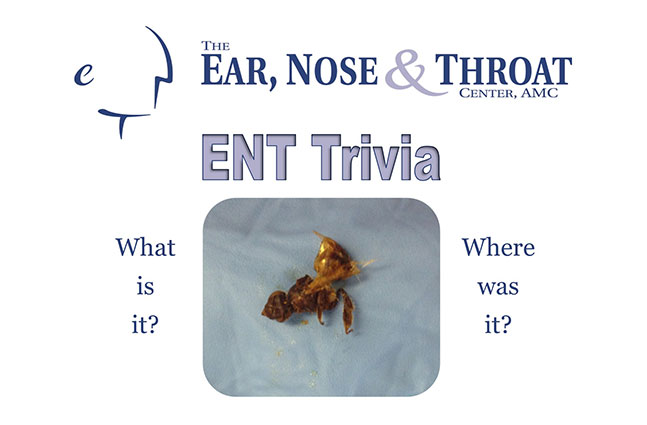 ENT Trivia